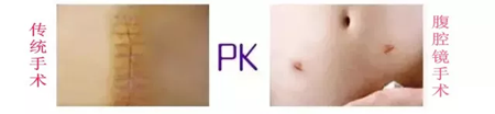 1533004494247812.png 西安安琪儿医院宫外孕